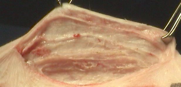 Innovative Electrosurgical Technology Hemostasis test